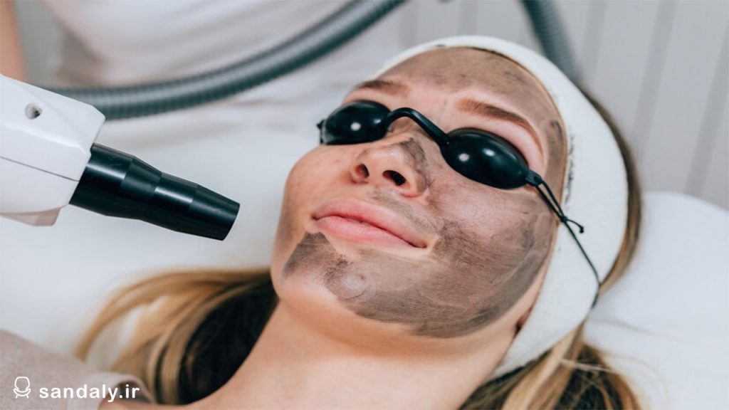 Carbon-therapy-for-facial-blemishes