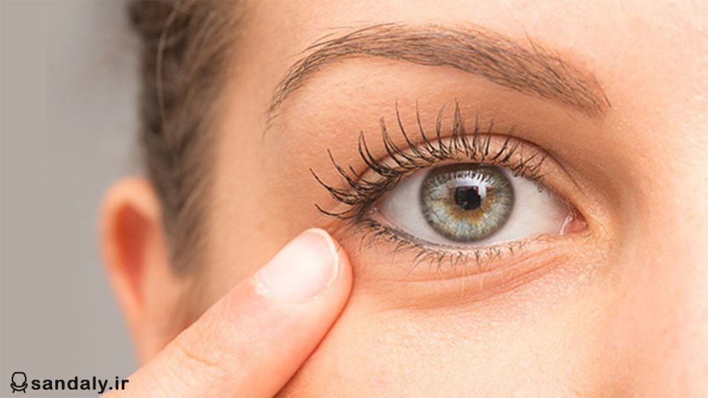 Ways-to-prevent-under-eye-bezels
